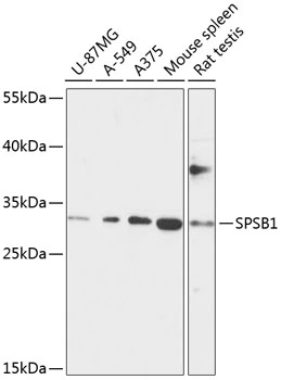 WB analysis of various sample lysates using GTX66222 SPSB1 antibody. Dilution : 1:1000 Loading : 25microg per lane WB analysis of various sample lysates using GTX66222 SPSB1 antibody. Dilution : 1:1000 Loading : 25microg per lane