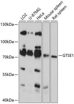 WB analysis of various sample lysates using GTX66223 GTSE1 antibody. Dilution : 1:3000 Loading : 25microg per lane WB analysis of various sample lysates using GTX66223 GTSE1 antibody. Dilution : 1:3000 Loading : 25microg per lane