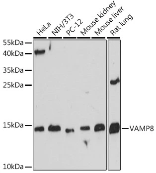 WB analysis of various sample lysates using GTX66224 VAMP8 antibody. Dilution : 1:500 Loading : 25microg per lane WB analysis of various sample lysates using GTX66224 VAMP8 antibody. Dilution : 1:500 Loading : 25microg per lane