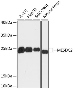 WB analysis of various sample lysates using GTX66225 MESDC2 antibody. Dilution : 1:3000 Loading : 25microg per lane WB analysis of various sample lysates using GTX66225 MESDC2 antibody. Dilution : 1:3000 Loading : 25microg per lane