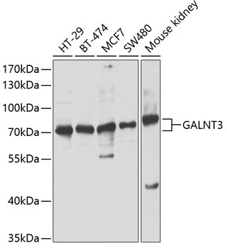 WB analysis of various sample lysates using GTX66226 GALNT3 antibody. Dilution : 1:1000 Loading : 25microg per lane WB analysis of various sample lysates using GTX66226 GALNT3 antibody. Dilution : 1:1000 Loading : 25microg per lane