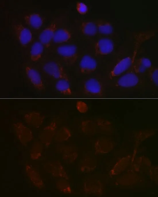 ICC/IF analysis of U2OS cells using GTX66226 GALNT3 antibody. Blue : DAPI Dilution : 1:100