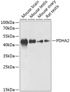 WB analysis of various sample lysates using GTX66228 PDHA2 antibody. The signal was developed with ECL plus-Enhanced. Dilution : 1:1000 Loading : 25microg per lane WB analysis of various sample lysates using GTX66228 PDHA2 antibody. The signal was developed with ECL plus-Enhanced. Dilution : 1:1000 Loading : 25microg per lane