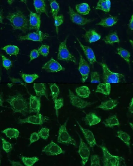 ICC/IF analysis of L929 cells using GTX66229 PTPN22 antibody. Blue : DAPI Dilution : 1:100