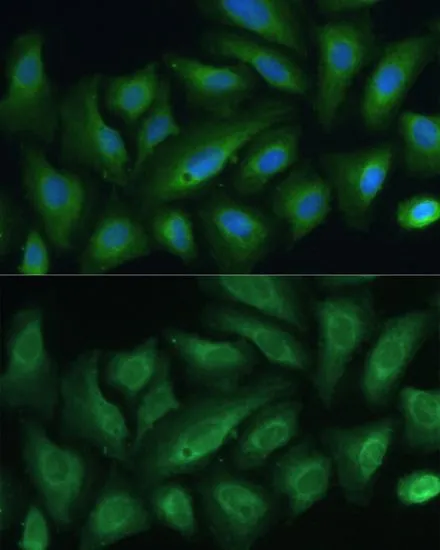 ICC/IF analysis of U2OS cells using GTX66229 PTPN22 antibody. Blue : DAPI Dilution : 1:100