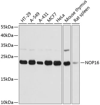 WB analysis of various sample lysates using GTX66230 HSPC111 antibody. Dilution : 1:3000 Loading : 25microg per lane WB analysis of various sample lysates using GTX66230 HSPC111 antibody. Dilution : 1:3000 Loading : 25microg per lane