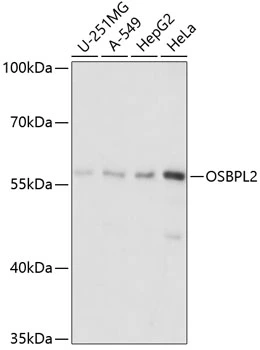 WB analysis of various sample lysates using GTX66235 OSBPL2 antibody. Dilution : 1:1000 Loading : 25microg per lane WB analysis of various sample lysates using GTX66235 OSBPL2 antibody. Dilution : 1:1000 Loading : 25microg per lane