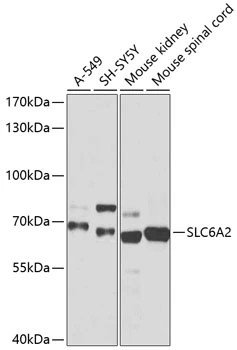 WB analysis of various sample lysates using GTX66236 SLC6A2 antibody. Dilution : 1:1000 Loading : 25microg per lane WB analysis of various sample lysates using GTX66236 SLC6A2 antibody. Dilution : 1:1000 Loading : 25microg per lane