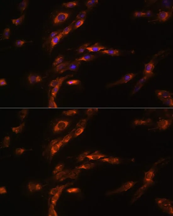 ICC/IF analysis of C6 cells using GTX66238 GABA A Receptor gamma 1 antibody. Blue : DAPI Dilution : 1:100