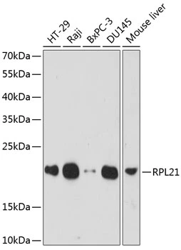 WB analysis of various sample lysates using GTX66241 RPL21 antibody. Dilution : 1:1000 Loading : 25microg per lane WB analysis of various sample lysates using GTX66241 RPL21 antibody. Dilution : 1:1000 Loading : 25microg per lane