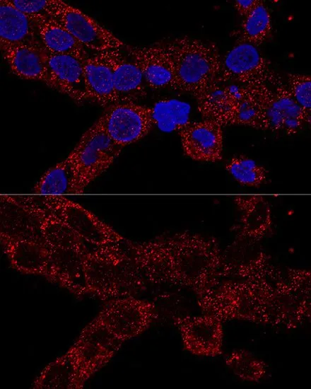 ICC/IF analysis of A431 cells using GTX66241 RPL21 antibody. Blue : DAPI Dilution : 1:100
