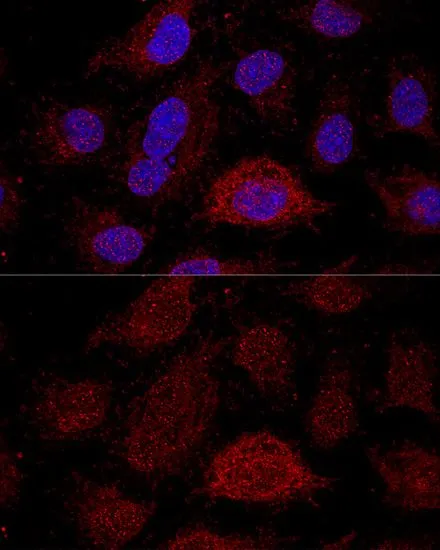 ICC/IF analysis of HeLa cells using GTX66241 RPL21 antibody. Blue : DAPI Dilution : 1:200