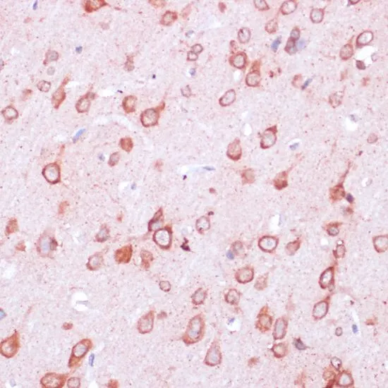 IHC-P analysis of rat brain tissue using GTX66241 RPL21 antibody. Dilution : 1:100