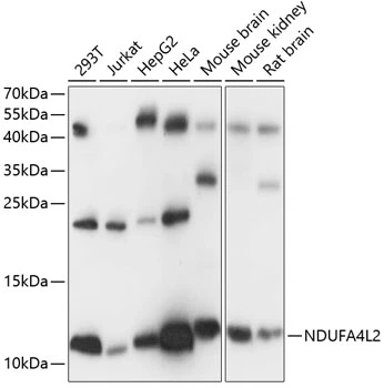 WB analysis of various sample lysates using GTX66244 NDUFA4L2 antibody. Dilution : 1:1000 Loading : 25microg per lane WB analysis of various sample lysates using GTX66244 NDUFA4L2 antibody. Dilution : 1:1000 Loading : 25microg per lane