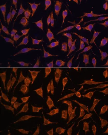 ICC/IF analysis of L929 cells using GTX66244 NDUFA4L2 antibody. Blue : DAPI Dilution : 1:100