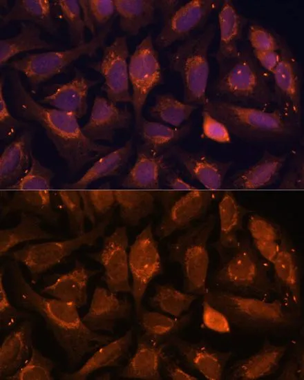 ICC/IF analysis of U2OS cells using GTX66244 NDUFA4L2 antibody. Blue : DAPI Dilution : 1:100
