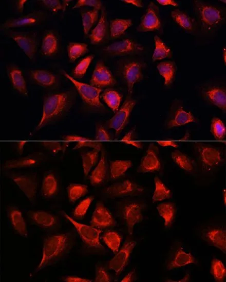 ICC/IF analysis of C6 cells using GTX66244 NDUFA4L2 antibody. Blue : DAPI Dilution : 1:100