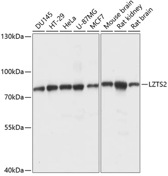 WB analysis of various sample lysates using GTX66271 LZTS2 antibody. Dilution : 1:1000 Loading : 25microg per lane WB analysis of various sample lysates using GTX66271 LZTS2 antibody. Dilution : 1:1000 Loading : 25microg per lane