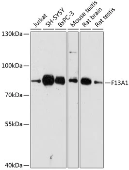 WB analysis of various sample lysates using GTX66274 Factor XIIIa antibody. Dilution : 1:3000 Loading : 25microg per lane