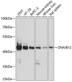 WB analysis of various sample lysates using GTX66277 DNAJB12 antibody. Dilution : 1:1000 Loading : 25microg per lane WB analysis of various sample lysates using GTX66277 DNAJB12 antibody. Dilution : 1:1000 Loading : 25microg per lane
