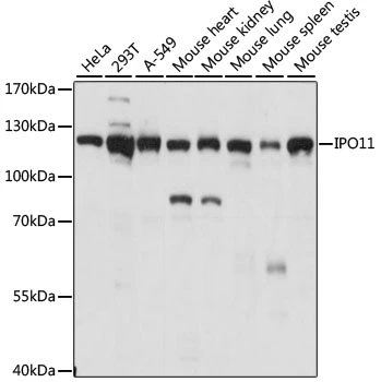 WB analysis of various sample lysates using GTX66281 IPO11 antibody. Dilution : 1:1000 Loading : 25microg per lane WB analysis of various sample lysates using GTX66281 IPO11 antibody. Dilution : 1:1000 Loading : 25microg per lane