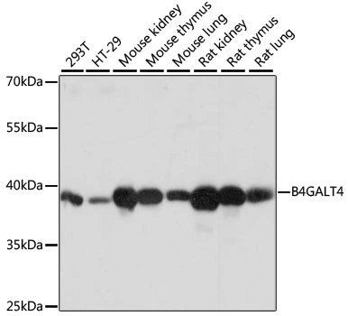 WB analysis of various sample lysates using GTX66282 B4GALT4 antibody. Dilution : 1:1000 Loading : 25microg per lane WB analysis of various sample lysates using GTX66282 B4GALT4 antibody. Dilution : 1:1000 Loading : 25microg per lane