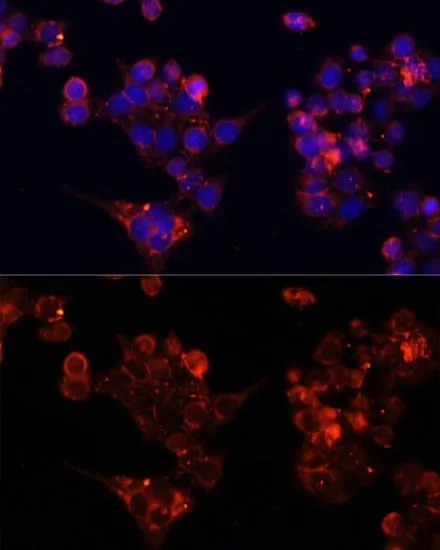 ICC/IF analysis of HeLa cells using GTX66282 B4GALT4 antibody. Blue : DAPI Dilution : 1:100