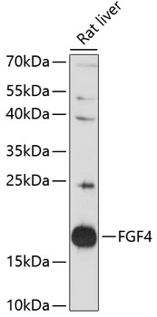 WB analysis of rat liver tissue lysate using GTX66284 FGF4 antibody. Dilution : 1:3000 Loading : 25microg per lane WB analysis of rat liver tissue lysate using GTX66284 FGF4 antibody. Dilution : 1:3000 Loading : 25microg per lane