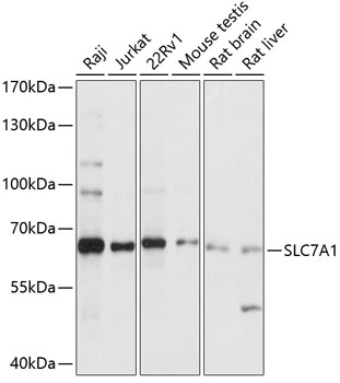 WB analysis of various sample lysates using GTX66289 SLC7A1 antibody. Dilution : 1:1000 Loading : 25microg per lane WB analysis of various sample lysates using GTX66289 SLC7A1 antibody. Dilution : 1:1000 Loading : 25microg per lane