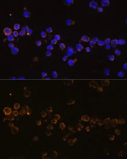 ICC/IF analysis of Jurkat cells using GTX66291 KLRC4 antibody. Blue : DAPI Dilution : 1:100