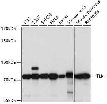 WB analysis of various sample lysates using GTX66297 TLK1 antibody. Dilution : 1:1000 Loading : 25microg per lane WB analysis of various sample lysates using GTX66297 TLK1 antibody. Dilution : 1:1000 Loading : 25microg per lane