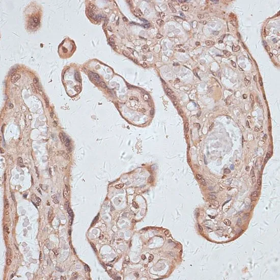 IHC-P analysis of human placenta tissue using GTX66297 TLK1 antibody. Dilution : 1:100