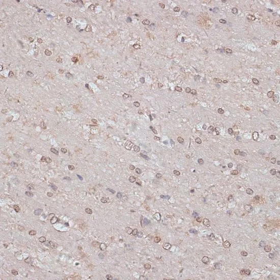 IHC-P analysis of mouse brain tissue using GTX66297 TLK1 antibody. Dilution : 1:100