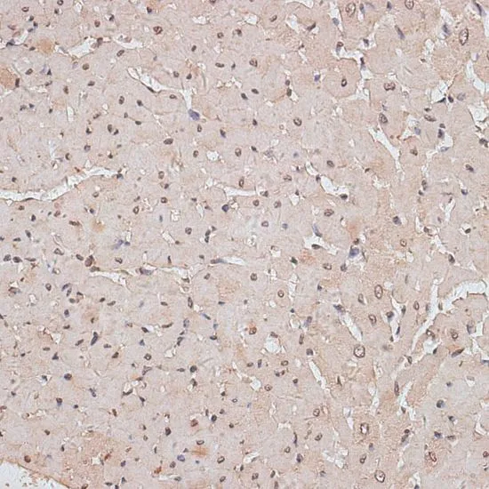 IHC-P analysis of rat heart tissue using GTX66297 TLK1 antibody. Dilution : 1:100