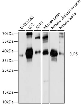 WB analysis of various sample lysates using GTX66300 C17orf81 antibody. Dilution : 1:1000 Loading : 25microg per lane WB analysis of various sample lysates using GTX66300 C17orf81 antibody. Dilution : 1:1000 Loading : 25microg per lane