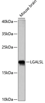 WB analysis of mouse brain tissue lysate using GTX66304 HSPC159 antibody. Dilution : 1:1000 Loading : 25microg per lane WB analysis of mouse brain tissue lysate using GTX66304 HSPC159 antibody. Dilution : 1:1000 Loading : 25microg per lane