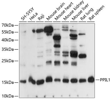 WB analysis of various sample lysates using GTX66307 PPIL1 antibody. Dilution : 1:1000 Loading : 25microg per lane WB analysis of various sample lysates using GTX66307 PPIL1 antibody. Dilution : 1:1000 Loading : 25microg per lane