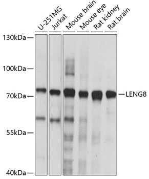 WB analysis of various sample lysates using GTX66314 LENG8 antibody. Dilution : 1:1000 Loading : 25microg per lane