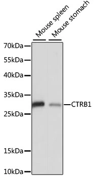 WB analysis of various sample lysates using GTX66324 CTRB1 antibody. Dilution : 1:1000 Loading : 25microg per lane WB analysis of various sample lysates using GTX66324 CTRB1 antibody. Dilution : 1:1000 Loading : 25microg per lane