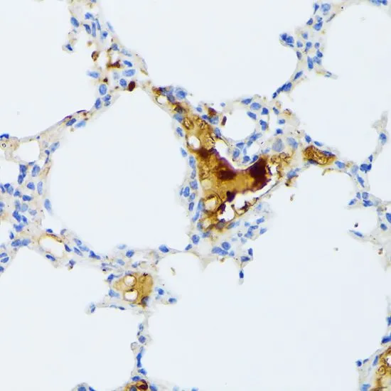 IHC-P analysis of mouse lung tissue using GTX66324 CTRB1 antibody. Dilution : 1:100