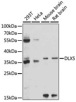 WB analysis of various sample lysates using GTX66325 DLX5 antibody. The signal was developed with ECL plus-Enhanced. Dilution : 1:1000 Loading : 25microg per lane WB analysis of various sample lysates using GTX66325 DLX5 antibody. The signal was developed with ECL plus-Enhanced. Dilution : 1:1000 Loading : 25microg per lane