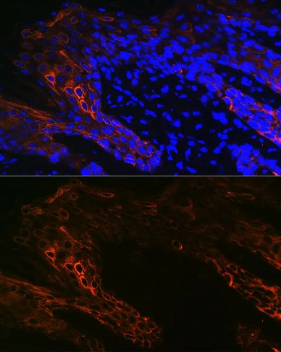 IHC-P analysis of Human skin tissue using GTX66326 Cytokeratin 14 antibody. Blue : DAPI Dilution : 1:100