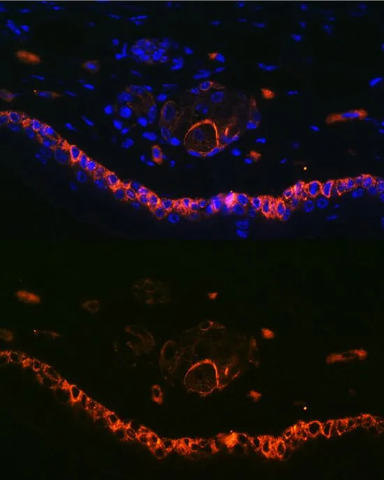 IHC-P analysis of mouse skin tissue using GTX66326 Cytokeratin 14 antibody. Blue : DAPI Dilution : 1:100