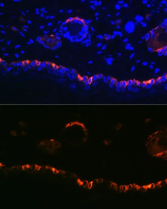 IHC-P analysis of rat skin tissue using GTX66326 Cytokeratin 14 antibody. Blue : DAPI Dilution : 1:100