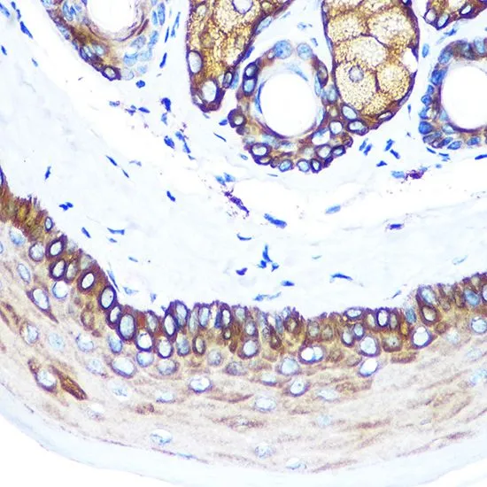 IHC-P analysis of mouse skin tissue using GTX66326 Cytokeratin 14 antibody. Dilution : 1:100