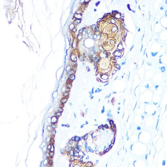 IHC-P analysis of rat skin tissue using GTX66326 Cytokeratin 14 antibody. Dilution : 1:100