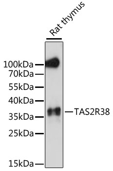 WB analysis of extracts of rat thymus tissue using GTX66329 TAS2R38 antibody. The signal was developed with ECL plus-Enhanced. Loading : 25ug per lane Dilution : 1:1000
