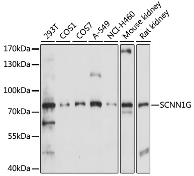 WB analysis of extracts of various cell lines using GTX66332 ENaC Gamma antibody. Loading : 25ug per lane Dilution : 1:1000