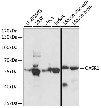 WB analysis of various sample lysates using GTX66335 OXSR1 antibody. Dilution : 1:1000 Loading : 25microg per lane WB analysis of various sample lysates using GTX66335 OXSR1 antibody. Dilution : 1:1000 Loading : 25microg per lane