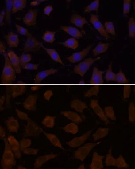 ICC/IF analysis of L929 cells using GTX66335 OXSR1 antibody. Blue : DAPI Dilution : 1:100